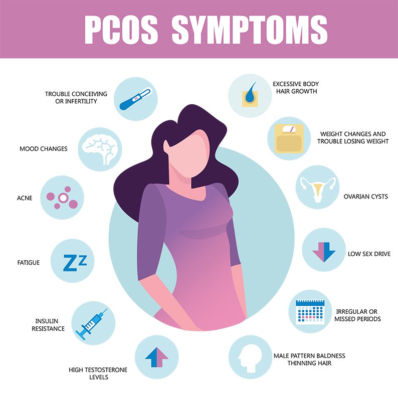 Symptoms and signs of PCOS infographic.