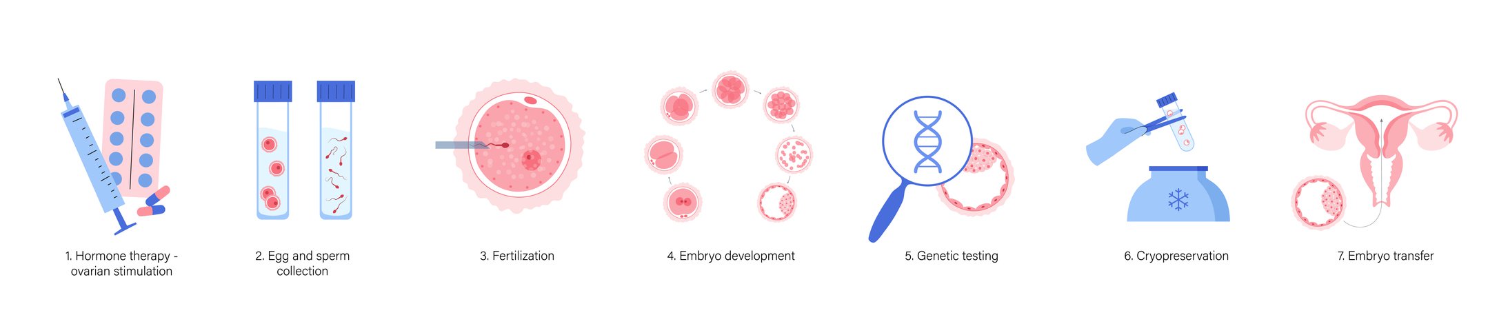 Stages of IVF cycle diagram.